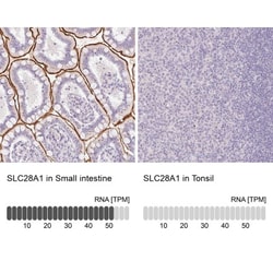 SLC28A1 Antibody, Novus Biologicals 0.1mL; Unlabeled:Antibodies, Polyclonal
